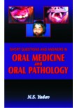 Short Questions and Answers in Oral Medicine and Oral Pathology, 2/Ed.