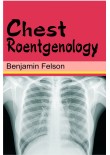 Chest Roentgenology, 1/Ed. (H.B.)